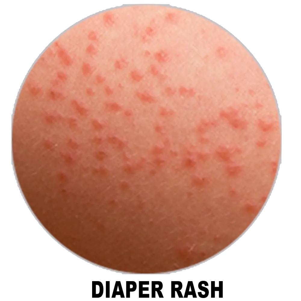 Best Rash Cream For Baby In 2025 2 Best Rash Cream For Baby