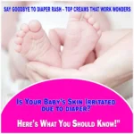 Best Rash Cream For Baby